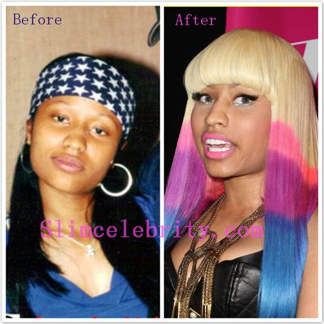 nicki minaj before and after pictures